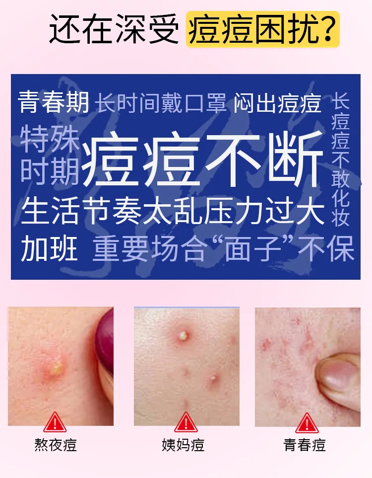 星星痘痘贴OEM代加工详情图2