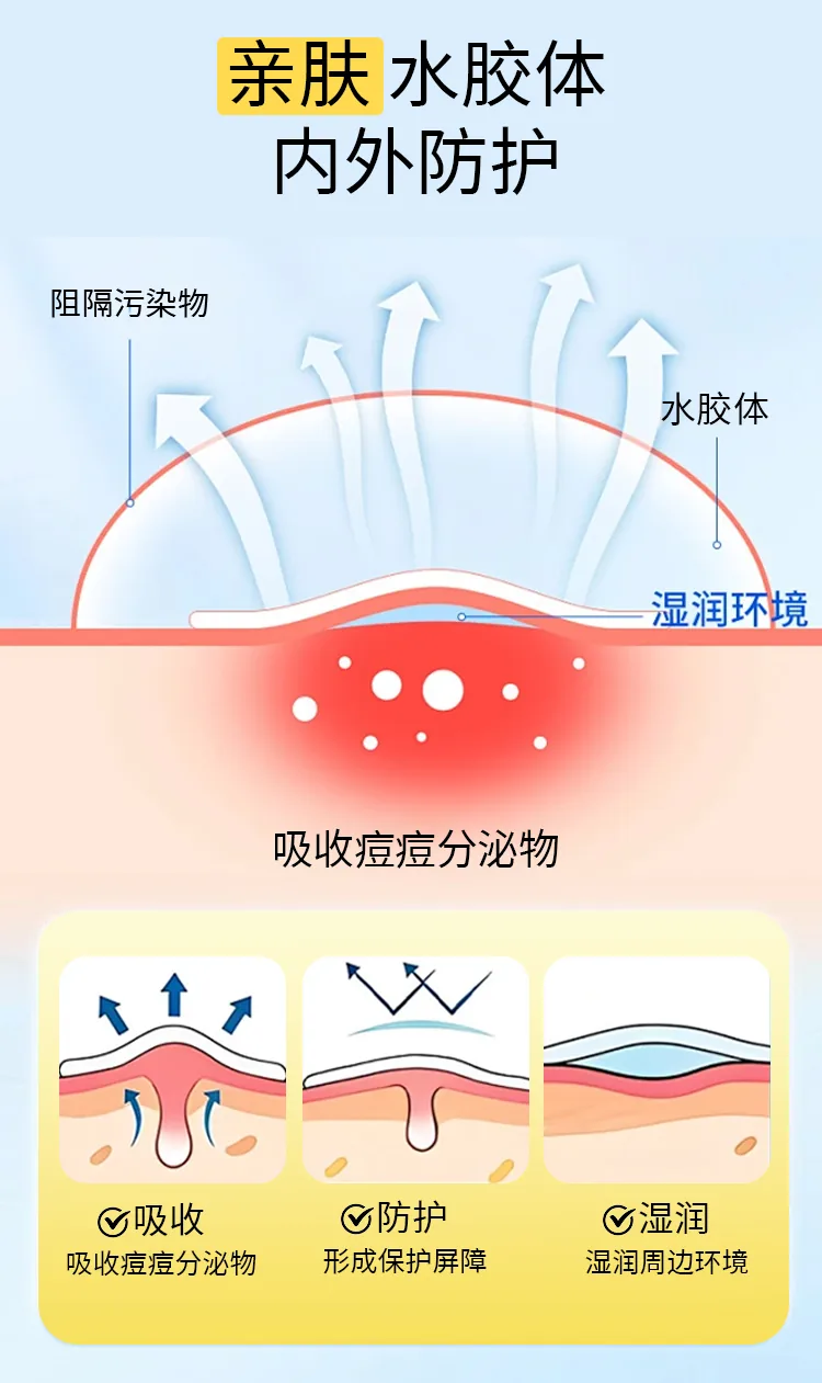 星星痘痘贴OEM代加工详情图6